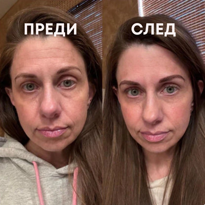 SkinQueen™ Tape 2.0 - Силиконови Ленти Против Бръчки 150см