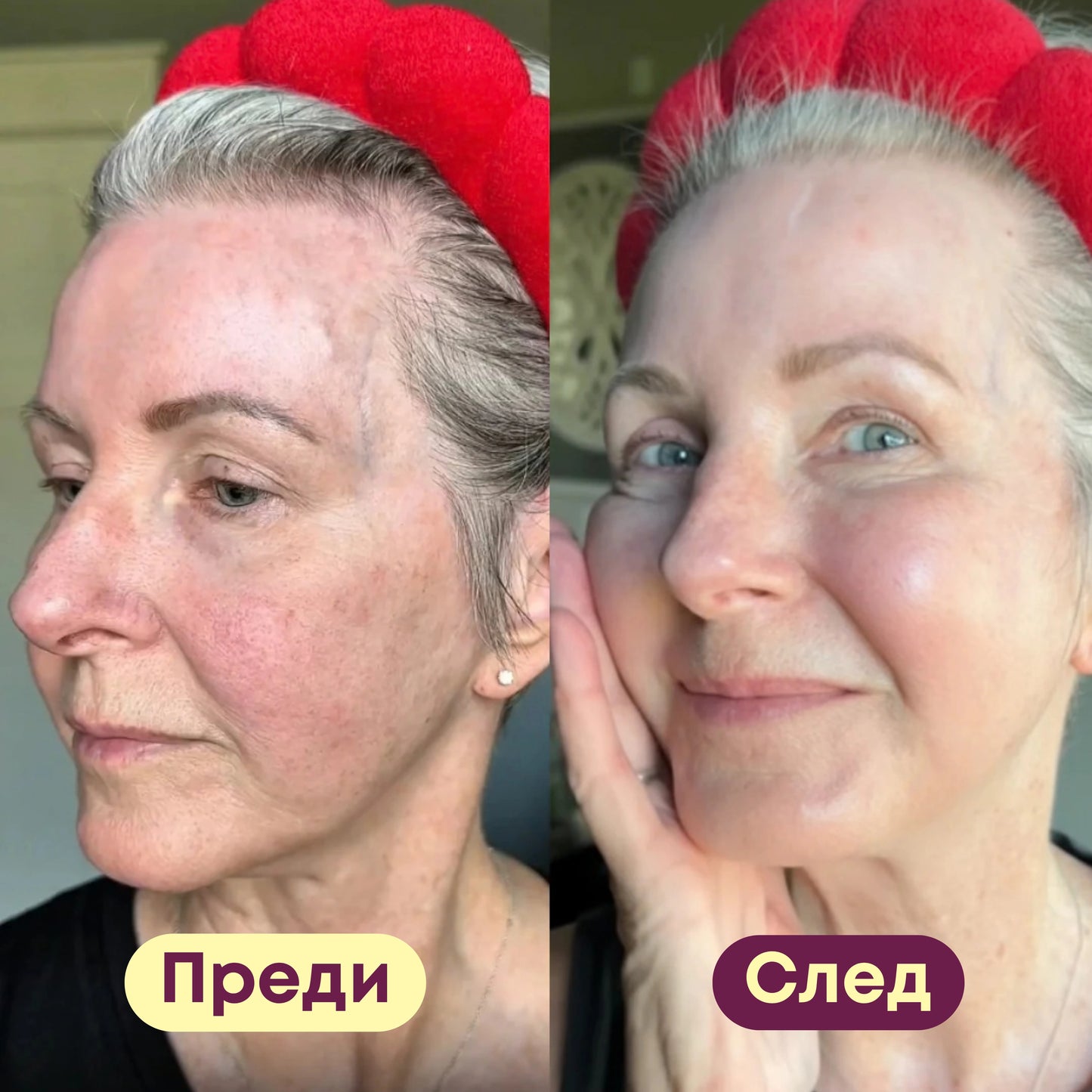 ПОДАРЪК PDRN Колагенова Маска