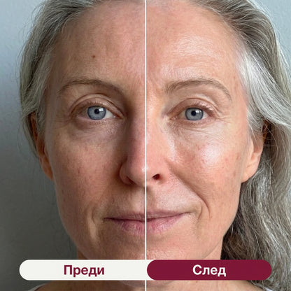 Skin Shine PDRN Колагенова Маска 5 бр